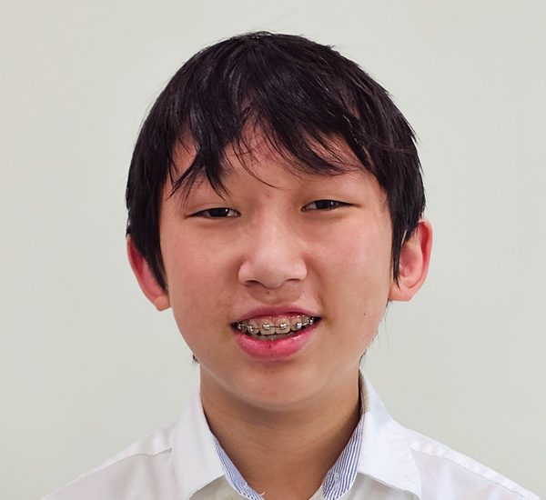 Evan Ung